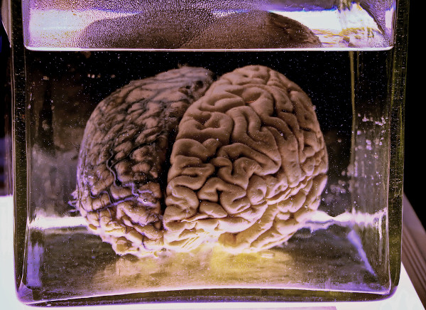 Cérebro humano conservado em um ambiente com formol.