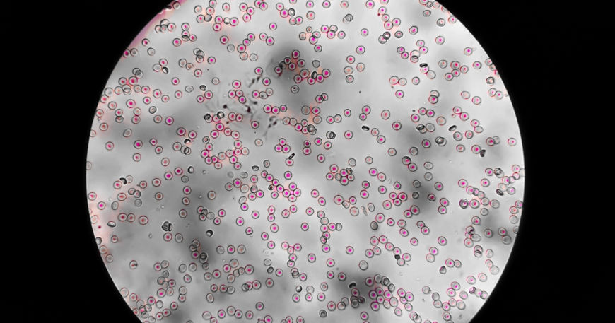 Gl&oacute;bulos do sangue vistos por um microsc&oacute;pio, exemplo de mistura heterog&ecirc;nea.